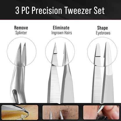 DUROX 3-Piece Tweezers Set for Ingrown Hair & Splinter Removal - 1. Pointed Ingrown Hair Tweezers, 2. Sharp Splinter & Sliver Remover, 3. Blunt Tip Facial & Chin Hair Tweezers, Stainless Steel, Pouch