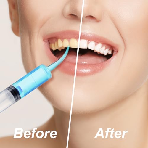 Zhengmy 100 Pcs Dental Syringe, Curved Tip,Without Capacity Scale, 12ml | Irrigation Syringes for Tonsil Stones, Mouthwash Cleaner Use, Curved Tip Reaches Difficult Areas, Capacity Scale for Dosing - style: Curved Tip ,Without Capacity Scale